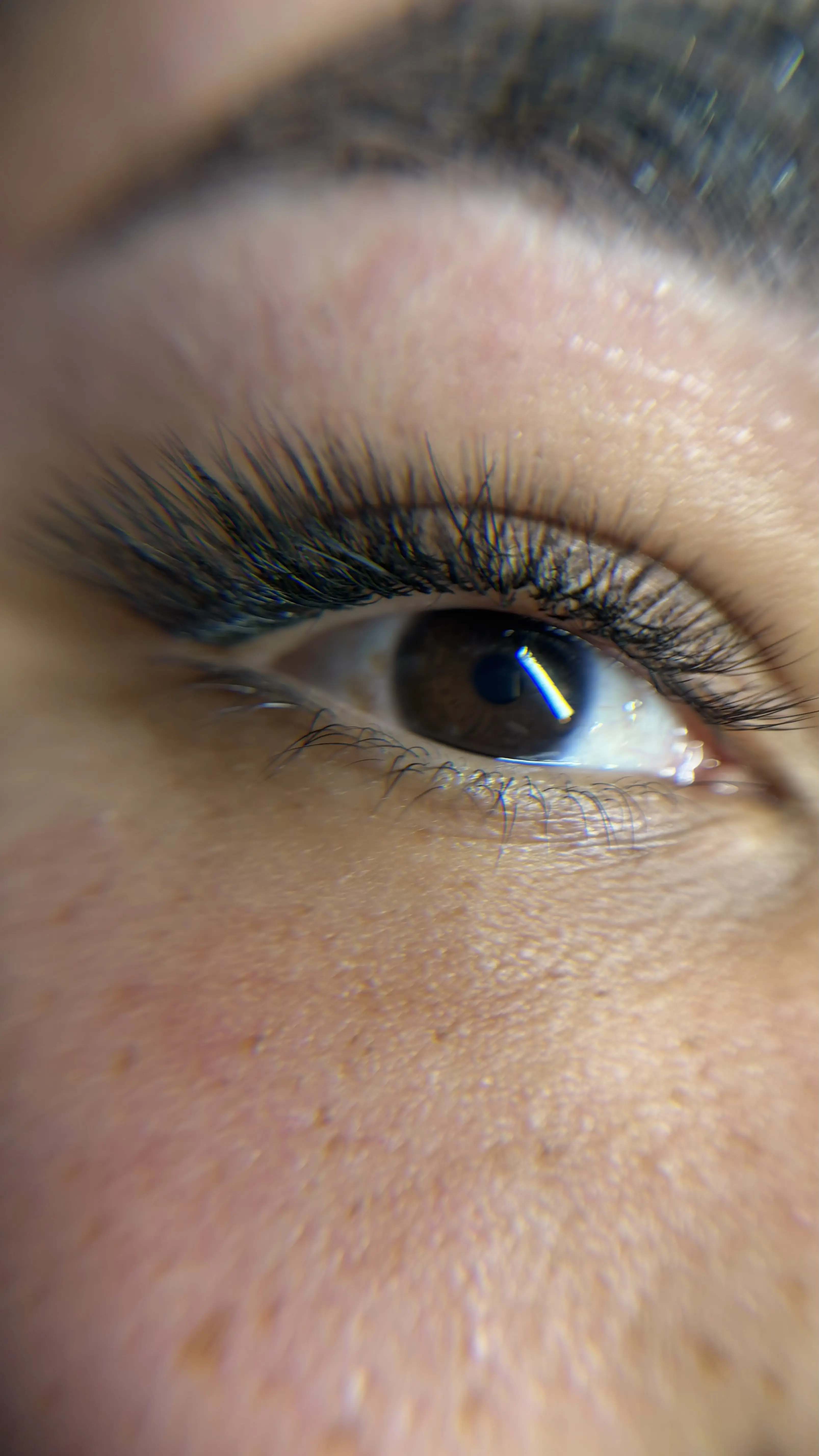 Fox Eye
